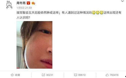 娱乐圈吃瓜爆料周冬雨,揭秘幕后真相